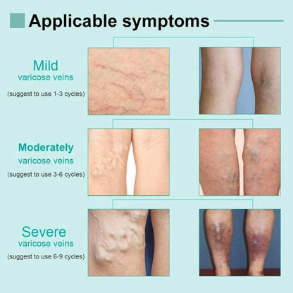 Varicose Deep Nourishing Soothing Vein Cream