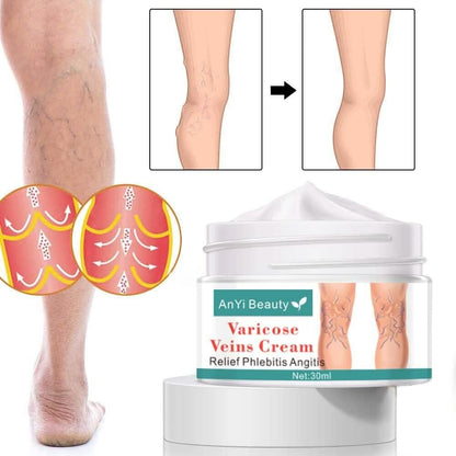 Varicose Deep Nourishing Soothing Vein Cream