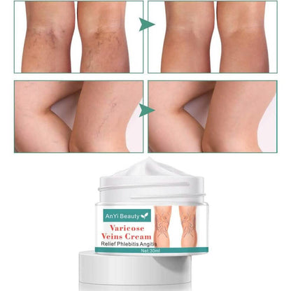 Varicose Deep Nourishing Soothing Vein Cream