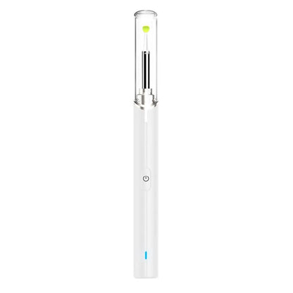 Intelligent Visual Ear Otoscope Inspection Tool